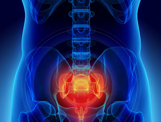 Coccydynia